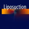 Liposuction 1st ed. 2018 Edition