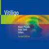 Vitiligo 2nd Edition