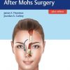 Facial Reconstruction After Mohs Surgery 1st Edition