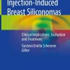 Injection-Induced Breast Siliconomas: Clinical Implications, Evaluation and Treatment 1st ed. 2020 Edition