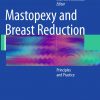 Mastopexy and Breast Reduction: Principles and Practice 2009 Edition