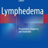 Lymphedema: Presentation, Diagnosis, and Treatment 2015th Edition