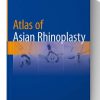 Atlas of Asian Rhinoplasty 1st ed. 2018 Edition