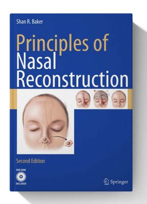 Principles of Nasal Reconstruction 2nd edition 1