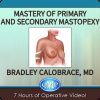 Mastery of Primary and Secondary Mastopexy
