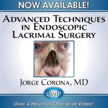 Home 1 Advanced Techniques in Endoscopic Lacrimal Surgery