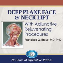 Deep Plane Face Neck Lift With Adjunctive Rejuvenating Procedures