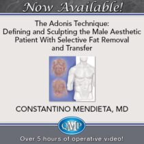 Home 1 The Adonis Technique Defining and Sculpting the Male Aesthetic Patient With Selective Fat Removal and Transfer