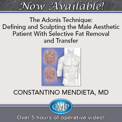 The Adonis Technique - Defining and Sculpting the Male Aesthetic Patient With Selective Fat Removal and Transfer The Adonis Technique Defining and Sculpting the Male Aesthetic Patient With Selective Fat Removal and Transfer
